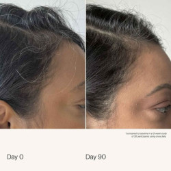 living proof scalp care density serum